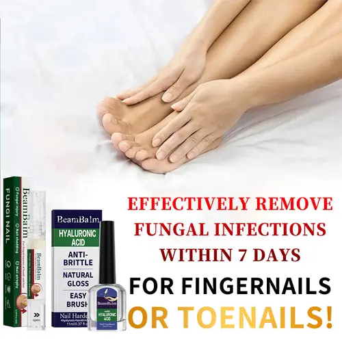 BEAMBALM Antifungal Nail Therapy Solution for Toenails & Fingernails - Strong Fungus Removal, Infection Prevention, Damaged Nail Repair & Renewal,sohochic