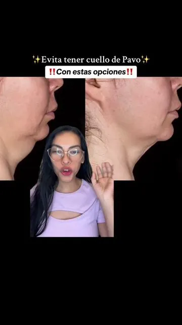 Evita de esta manera tener un cuello de pavo ✨ #turkeyneck #gopure #pielflacida #saggingneck #cuidadodelcuello #cuidadodelapiel #skincaretipsforyou #cleanskincare #productosdeskincare #recomendaciones #tusisterjurissa 
