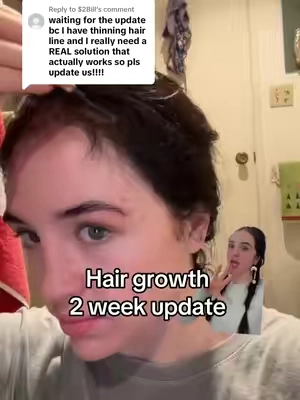 Replying to @$2Bill I also feel like it’s important to note that I’ve noticed less of my hair falling out in the shower/when brushing. I’ve been pretty high stress lately, so it’s impressive that my hair is not falling out as much. 😵‍💫😵‍💫😵‍💫 #hairgrowth #longhair #rapidhairgrowth #highfrequencywand #hair #nuderma #greenscreenvideo #greenscreen 