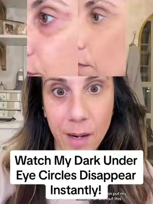 Replying to @adelegoldsworthy  My new MUST HAVE every morning, instantly diminish rhe appearance of under hollowing and dark circles! If using concealer with this product, this is how you use it to achieve optimal results!  @Peter Thomas Roth Labs You did it again!!! 🙌🏼 #peterthomasroth #peterthomasrothinstantfirmeye #wrinkleeraser ##maturemakeup #over40 #over40makeup  