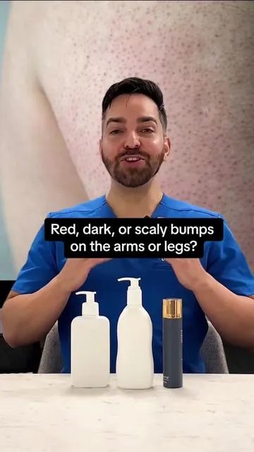 Red, scaly bumps on the arms? Keratosis pilaris, also known as chicken skin, is caused by a build up of keratin around the hair follicle Urea, lactic acid, and retinol are the three best ingredients and usually found in separate products @Remedy Science we took them all and put them in one formula to simplify your routine with an all-in-one solution Now available!