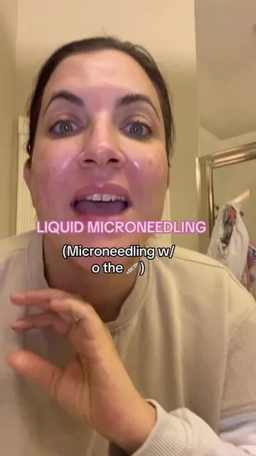 microneeding in a bottle?? This is my third at-home treatment with the @medicube_official Exosome Shot My skin texture has improved, my pores look more refined, and my skin is more glass-like.  If you have skin that's prone to hyperpigmentation and large pores this could help to improve it over time! Exosomes are actually high end ingredients used in Korean clinics so you basically have a skincare clinic in a bottle with this duo!  #LiquidMicroneedling #ExosomeShot #medicube #glowbooster #texturecare #acnecare #skinbooster #kbeauty #koreanskincare #microneedling #facialtherapy #poreminimizer 