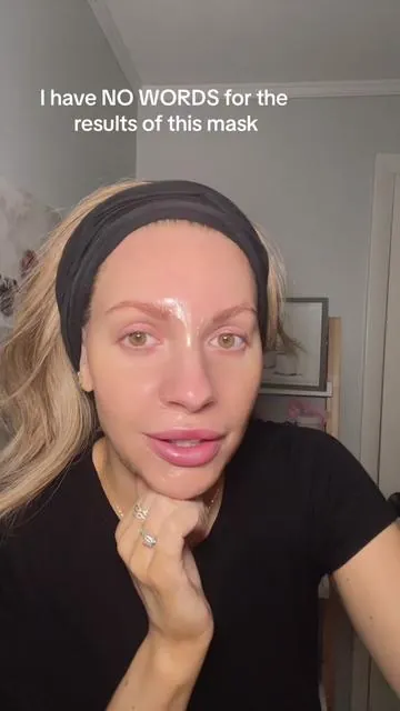 This is actually insane you can get results like this without botox!!!! #collagenmask #antiwrinkletreatment #wrinkles #botoxnatural #tiktokshopsummersale 