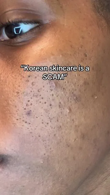 Asian dont raisin… 