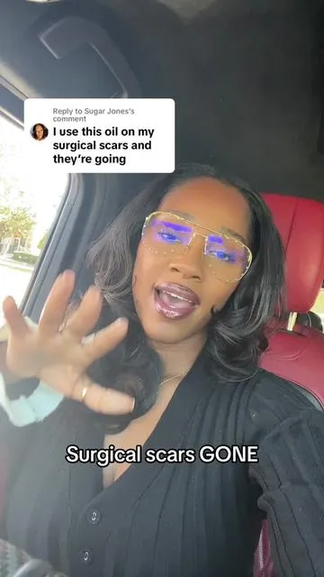 Replying to @Sugar Jones  surgical scars gone! Bikini and booty hole bright as a light with Salt.xo #saltxo #hygienetips #femininehygiene 