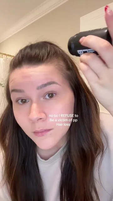 Like magic in a bottle✨😻 I use it to cover up hair loss ever since having my 3rd baby!  @@boldify   . . . . #pphairloss #hairlosssolutions #deal #dealsforyoudays #dealsforyou #dealsoftheday #deals #dealsoftheweek 