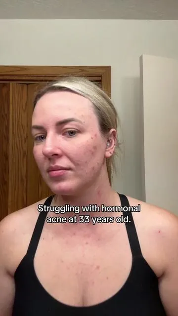 I promise this is a TikTok shop win for skincare @DRMTLGY #drmtlgy #skincare #medicalgradeskincare 