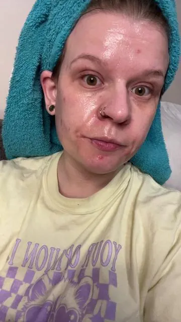 #fyp #viral #upstateny #🤷🏼‍♀️ #skincare #medicube #truth I’m not gonna lie to it’s kind of hard to post this but here’s an honest review @Medicube Global 