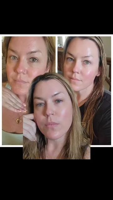 A week and half in! I am obsessed.  #fyp #viral #tiktokmademebuyit #skincaretips #skincareobsessed #kbeauty #koreanskincare #skincareroutine #glowup #selfcare #medicube #medicubeskincare #medicubecushion #medicubeporeserum #medicubeporecleanser #redcushion #kbeautyfaves #medicubereview #honestreview #tiktokshop #tiktokshopfinds #musthave #beautyfinds #tiktokshopreviews #tiktokshopskincare #shopnow #beforeandafter #glowyskin #poresnomore