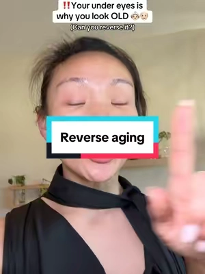 It’s not too late to get started #rejuran #undereyebags #undereyecircles #undereyebrightener #pdrnserum #rejuranampoule 
