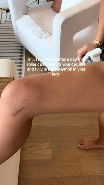 Smooth legs, better circulation, and real results—this roller targets cellulite, supports lymphatic drainage, and feels like a deep tissue massage at home. Use daily and thank me later. #celluliteroller #lymphaticdrainage #bodycaretools #tiktokmademebuyit #sculptingtool #wellnesstok #selfcarerituals #draintok #smoothskinroutine #viralbeautytools 