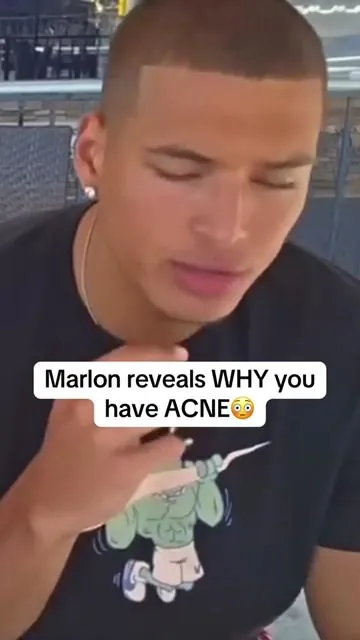 I wish I knew this earlier #marlon #acne #guthealth #probiotics 