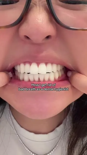 Bad breath can stem from poor hygiene and even systemic conditions; however, I believe that incorporating a good oral hygiene routine can definitely help alleviate bad breath! #euthymolpartner #badbreath #fyp #oralhygiene #dentalhygienist #oral #routine #tonguescraping #plaque #bacteria #euthymol #whiteningtoothpaste #TeethWhitening #KoreanTeethWhitening #PinkToothpaste #yellowteeth #oralcare #whiteteeth #bloomkare @Bloomkare 