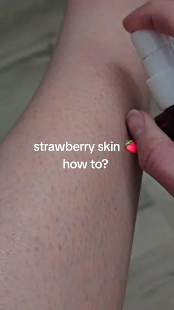 #strawberryskin #medicube #medicubeambassador #ingrownhair 