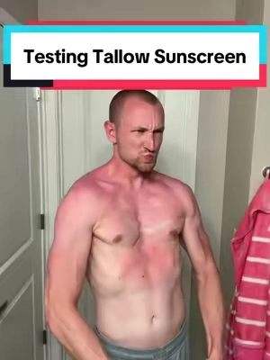 Ur welcome 😭 #sunscreen #tallow #sunburn 