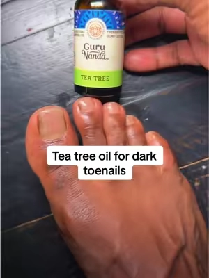 Replying to @Unapologetically Me ✨ yesss tea tree oil has done a thing on my hubby black toenails 🙌🏽🙌🏽@GuruNanda LLC @Elizabeth  #teatreeoil #toenails #darktoenails #toenailfungus #gurunanda #toes 