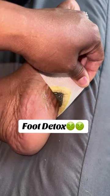Foot detox🤢 We slept so good after using these! Definitely try them out!!  #footdetox #detoxpads #footdetox #soleserenityfootpads #feet #detox #tiktokshopcreatorpicks 