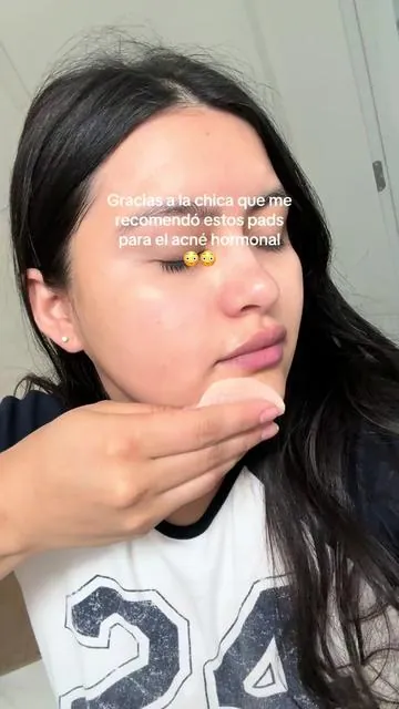 Ahora ya no los quiero dejar de usar😳también probé los azules y los amé te deja esa piel de espejo 🪞 y los estos me están ayudando con mi acné hormonal no se si sea solo a mi pero si tú ya los probaste dime cómo te funcionaron? 🫢💖 @medicube global  #medicube #medicubepads #medicubeskincare #medicubetiktokshop #skincaretips 
