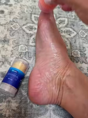 You HAVE to try this!! Wow! Game changer yall!! #wow #gamechanger #dry #dryfeet #cracked #crackedskin #sogood #excellent #smellsamazing #works #tiktokshop #excited #feet #foot #dryskin #feelssogood #roller #bogo #hurry #foryoupage #foryourpage 