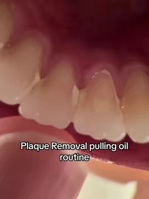 I’m so impressed #plaqueremoval 