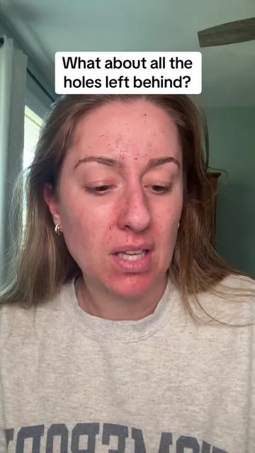 #drmelaxin #glowingskin #peelshot #tiktokshopcreatorpicks 