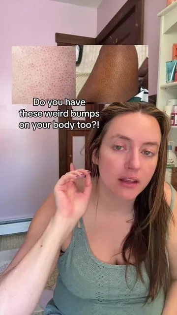 Replying to @HeyCrystall the difference is night and day ! #tiktokshopfalldealsforyou #strawberryskin #peelshot #drmelaxinbodypeelshot #kp  @Dr.Melaxin Global @Dr Melaxin Official  