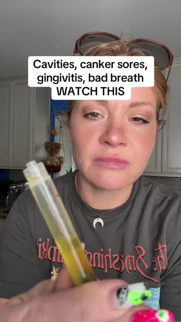 You do not have to suffer with dental pain! *hot tip: spit this out in the trash you do not want to spit oil in your plumbing and have problems.* Obviously results can vary but omg this blew my mind!  ##cavities##gingivitis##badbreath##kidsdentist##ozonetherapy