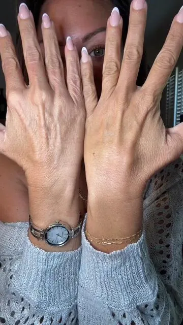 Retinol medical grade body lotion. Because your skin is craving deeper hydration. Diminishes age spots, stretch marks, improves elasticity. You can mix with a regular lotion to make it last longer. #retinol #retinolskincare #skincareroutine #skincare #over40skincare 