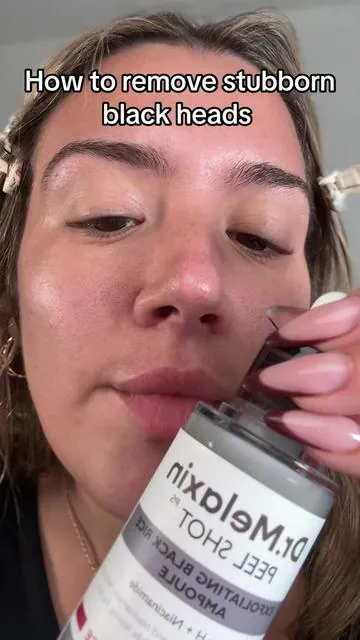 Dr.melaxin has officially declogged my large pores !!#drmelaxin #largepores #blackheadextractor #blackheadremover 