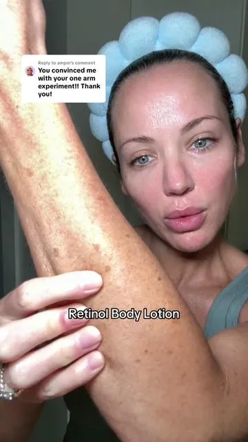 Replying to @ampm I can confidently say after using this going on almost a month I’m freaking in love with this brand #drmtlgy #retinol #retinollotion #bodycare #hyperpigmentation 