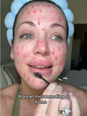Spicules is hands down the best skincare invention I’ve seen and of course it’s straight out of South Korea  #spiculeserum #microneedlinginabottle #glassskin #drmelaxin #koreanskincare 