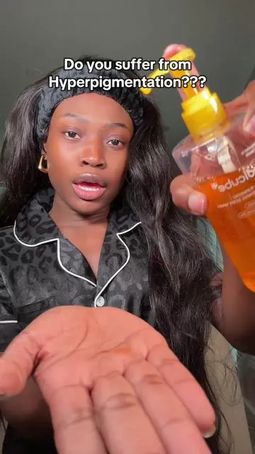 Me and this Kojic Acid Tumeric are BESTIESSS💓💓 it gradually changes over time. I’ve been using this CONSISTENTLY for about 3 weeks. Morning & Night🤍🤍 @medicube US Store @medicube global #medicube #kojicandturmericsoap #tiktokshopblackfriday #tiktokshopcybermonday #hyperpigmentation 