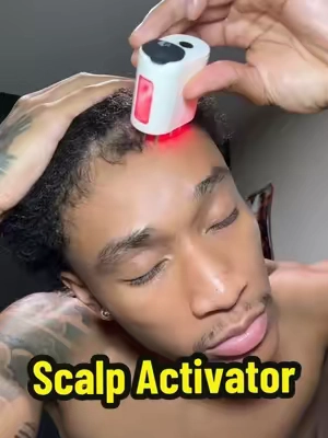 Laser hair growth thank you! #hairgrowth #hairline #hair #menshair #hairloss 