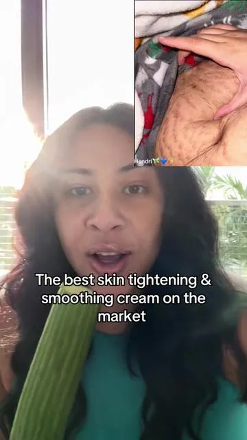 The results just don’t tell any liessssssssss #gopurebeauty #gopurecream #stretchmarks #tighteningcream #tiktokshopblackfriday 