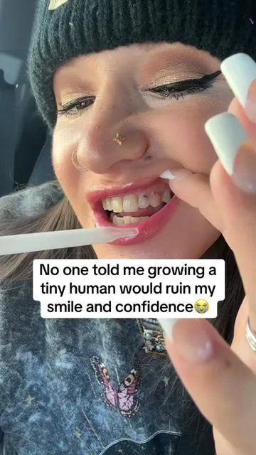 If you have tooth pain, cavities, bad breath, it receding gums, meet Dentite Tooth Armor 🦷✨ It uses hydroxyapatite, the clean mineral your enamel is made of, to support stronger teeth, smoother sensitivity, and a fresh, balanced oral microbiome. gentle, and clean-girl approved 🌿 ✨These are my opinions. Please check reviews, do your own research, and make informed decisions as results may vary!! #Hydroxyapatite #oralhealth #pregnancyproblems #TikTokShopCreatorPicks #TikTokShopBlackFriday