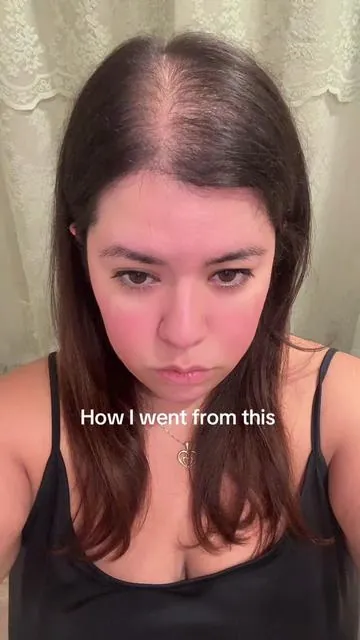 I feel pretty with my hair fibers 💜#minoxidil #hairloss #hairlossjourney #hairfibers #boldify #hairlosssolution #thinninghair #androgenicalopecia #femalepatternhairloss #hairtok #fyp @@boldify 