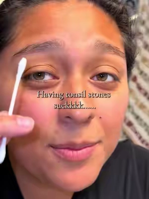 This could be causing your bad breath 😷 #tonsils #tonsilrinse #tonsilstones #badbreath #fypシ゚viral 