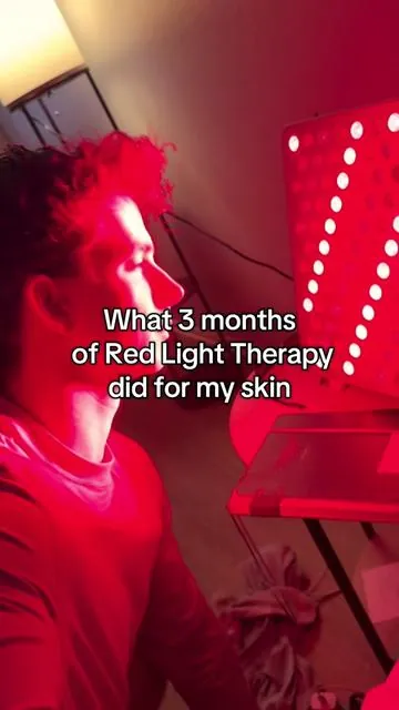 Red light therapy works wonders. i’ve never used a mask, but I was using this panel throughout this time. And I also restricted my diet in case anyone was asking. I cut out dairy, gluten and sugars. I’ve used the panel and the mask, I like them both but the panel you can incorporate into more things, the mask i like to use when i’m reading or not doing anything.  #skincare #healing #acne #recovery #CapCut 