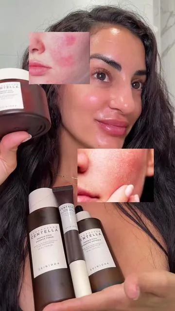 Está línea completa es otro nivel!! @SKIN1004 US #skin1004 #cica #skincaretips #sensitiveskin #tiktokshopholidayhaul 