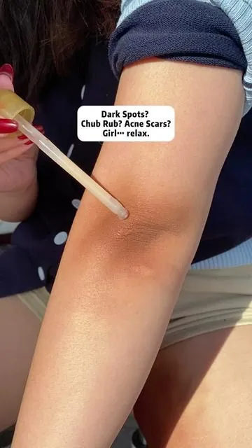Dark Spots? Chub Rub? Acne Scars? Girl… relax!#drmelaxin #drmelaxinpeelshot #discoloration #darkspots #bodyexfoliator  