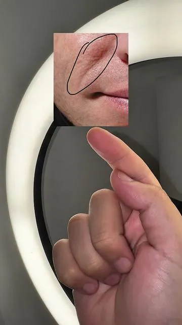 YOU NEED THIS Stop Fine Lines Before They Start!!! @anua_global  #anuapdrncream #glassskin #koreanskincare  #tiktokshopcreatorpicks #tiktokshopholidayhaul 
