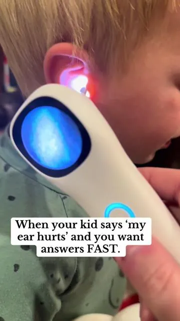 If you’re a parent, you NEED this. This is a 5-in-1 smart otoscope, and it lets you actually see inside your child’s ears in real time. It has a bright HD camera, a clear screen, and a built-in light, so you’re not guessing if it’s wax, irritation, or something that needs a doctor. I love it for peace of mind — especially when they say their ear hurts at night or on the weekend. It’s gentle, easy to use, and honestly one of those parent tools you don’t realize you need until you have it. Tap to grab one and thank yourself later. #ParentMustHave #MomTok #DadTok #KidsHealth #ParentingHack