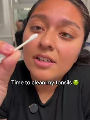 Tonsil stones suck… #tonsils #tonsilstones #badbreath #teethcare #trending 