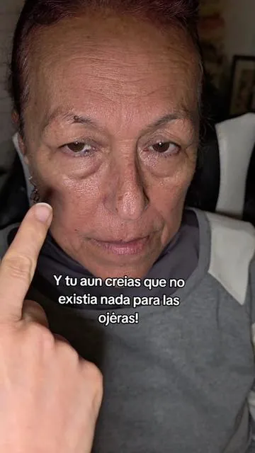 Ahora mi mama se siente mas agusto y feliz de salir a la calle.  Mujeres 30+ Mujeres 40+ #ojeras #ojerastips #undereyebags #undereyecircles #eyephalt 