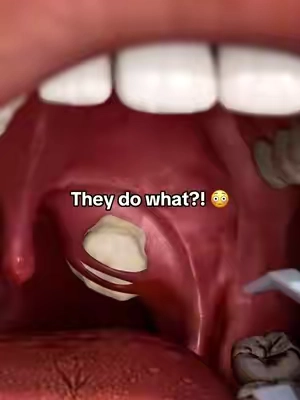 There’s always a better alternative 😅 #tonsils #tonsilstones #badbreath #teethcare #viralllllll 