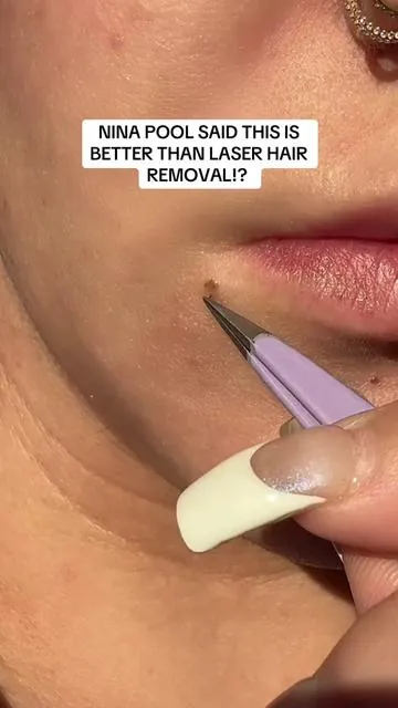 Who knew Cyprus rotundus oil could be so effective at hair removal!? #hormonalhair #facialhair #hairremoval #cyprusrotundusoil #ninapoolhacks 