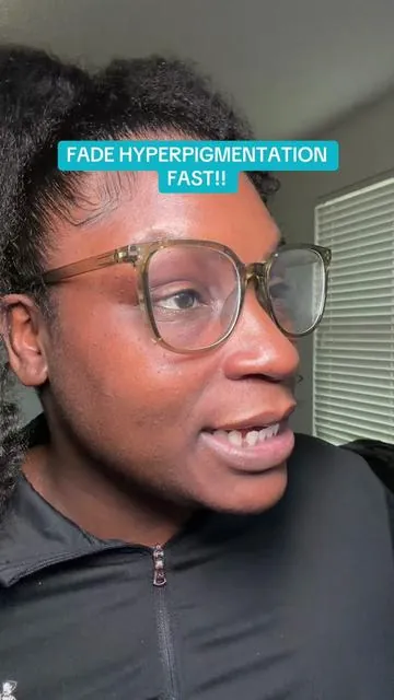 Add this AZELAIC ACID SERUM to your skincare routine!! #azelaicacid #azelaicacidserum #hyperpigmentation #darkspots #darkspottreatment 