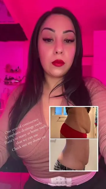 It took me a year, but definitely worth it. Consistency is key and the health of your lymphatic system. There are so many tools out there that we can use to start our journey. All I can say is be consistent if you mess up get back up and make your next hour count.#lymphaticdrainage #detox #lymphaticdrainagemassage #lymphaticsystem #skinfirming 