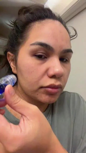 #microneedling #highmaintenancetobelowmaintenance #highmaintenance 