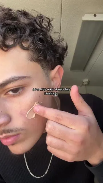 Tinted Sunscreen Method #tiktokshop #tintedsunscreen #acne 